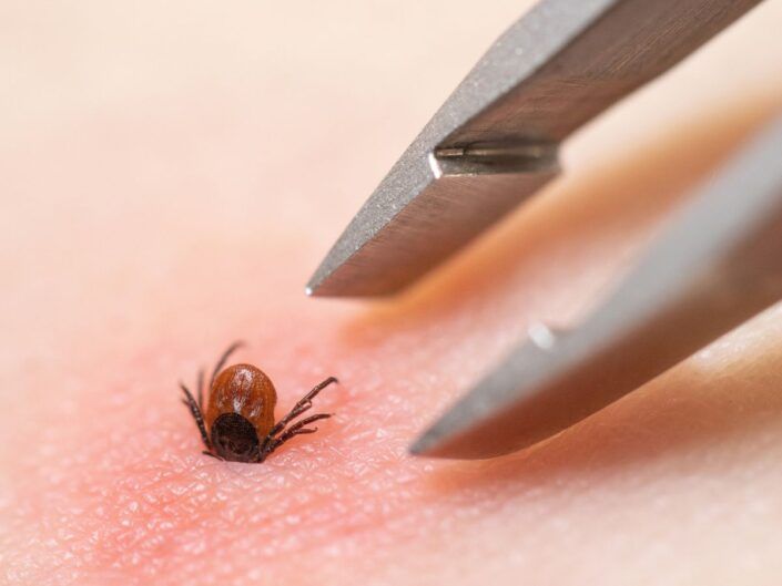 як правильно забрати кліща